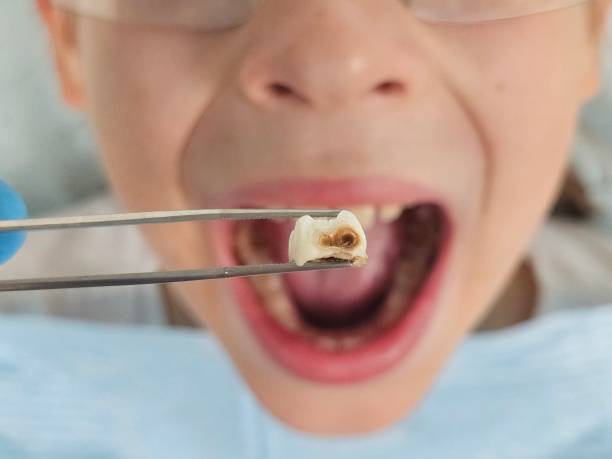 Best After-Hours Emergency Dentist in Lowesville, NC