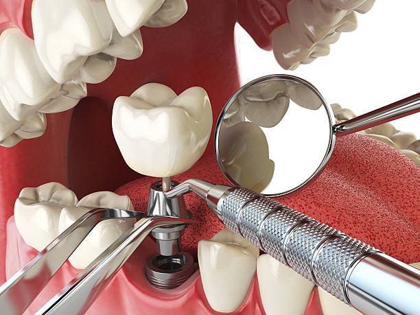 Best Same-Day Emergency Dentist in Lowesville, NC